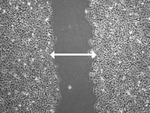 Trước khi quản lý
