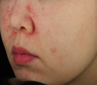 Sau 1 ngày sử dụng sản phẩm